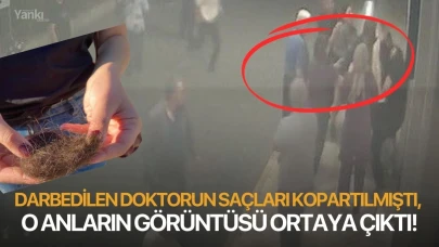 Darbedilen doktorun saçları kopartılmıştı, o anların görüntüsü ortaya çıktı!