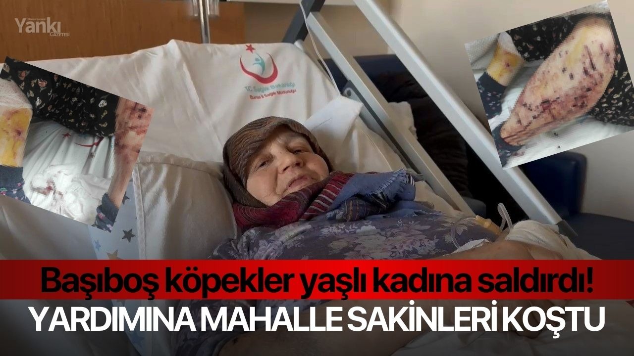 Başıboş köpekler yaşlı kadını yaraladı! Yardımına mahalle sakinleri koştu