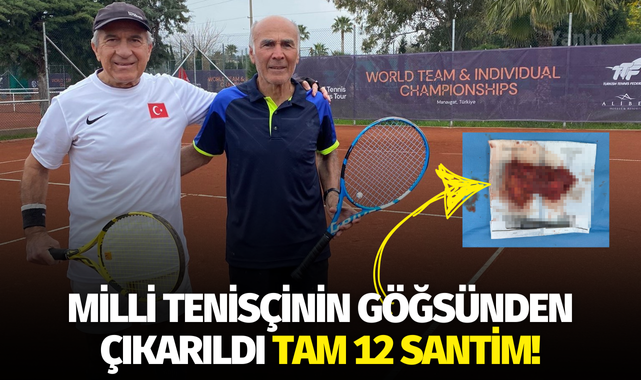 Milli tenisçinin göğsünden çıkarıldı tam 12 santim