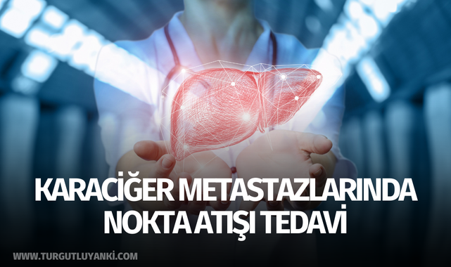 Karaciğer metastazlarında nokta atışı tedavi