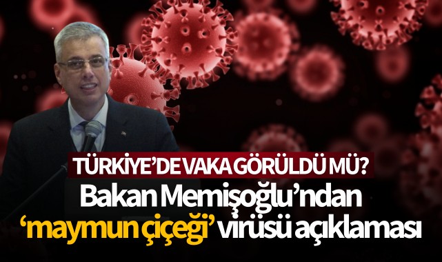 Bakan Memişoğlu’ndan maymun çiçeği virüsü açıklaması