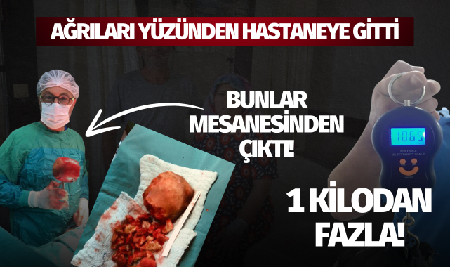 Bunlar mesanesinden çıktı: 1 kilodan fazla!