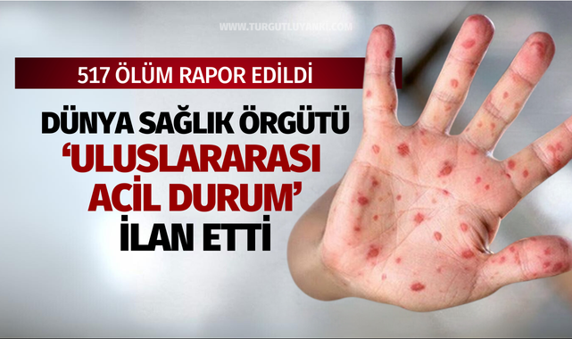 DSÖ 'Uluslararası Acil Durum' Etti! 517 kişi hayatını kaybetti