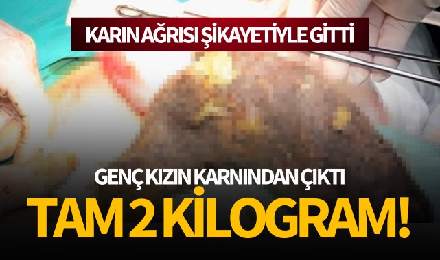 Genç kızın karnından çıktı: Tam 2 kilo!