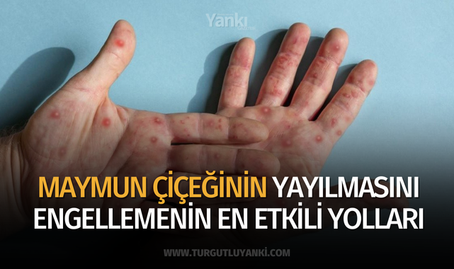 Maymun çiçeğinin yayılmasını engellemenin en etkili yolları