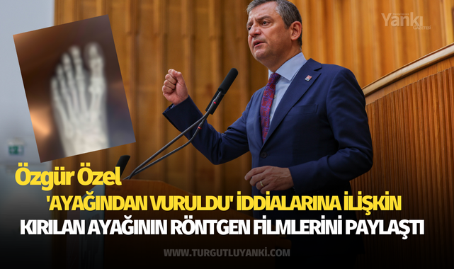 Özgür Özel 'ayağından vuruldu' iddialarına ilişkin kırılan ayağının röntgen filmlerini paylaştı