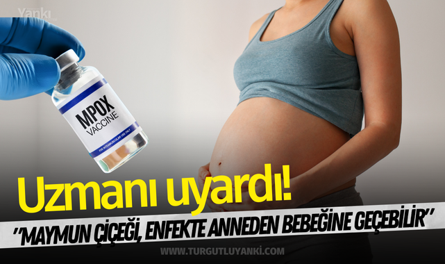 Uzmanı uyardı! "Maymun çiçeği, enfekte anneden bebeğine geçebilir"