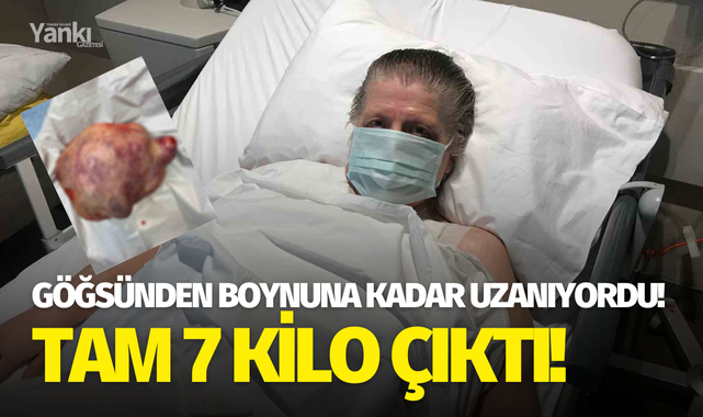 Göğsünden boynuna kadar uzanıyordu! Tam 7 kilo çıktı..