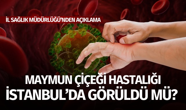 İstanbul'da maymun çiçeği görüldü mü?