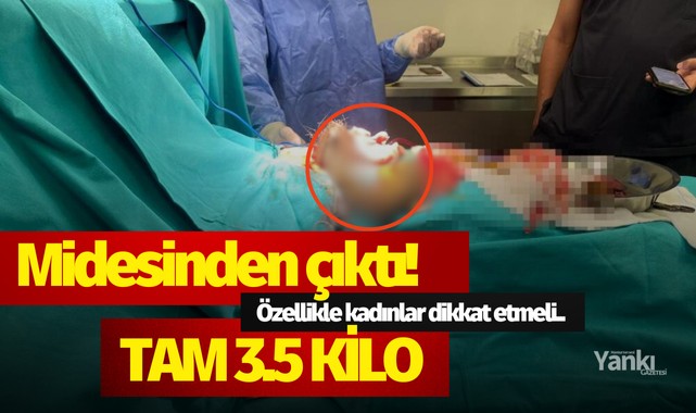 Midesinden çıktı! Tam 3.5 Kilo..