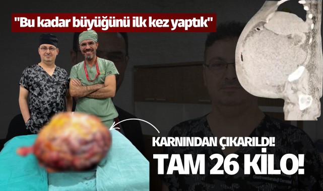 Karnından çıkarıldı: Tam 26 kilo!