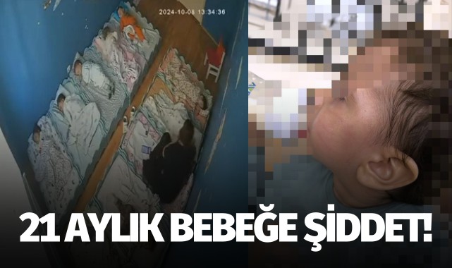 Kreşte 21 aylık bebeğe şiddet!